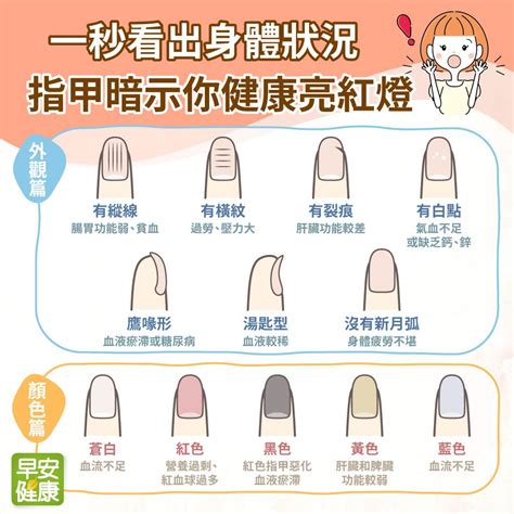 手指指甲病變|指甲凹陷、冒出黑線…指甲生病了嗎？9指標自我觀。